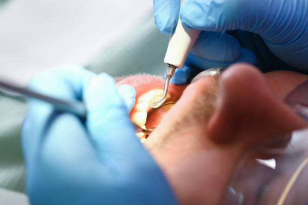 Best Knocked-Out Tooth Emergency  in Slaton, TX